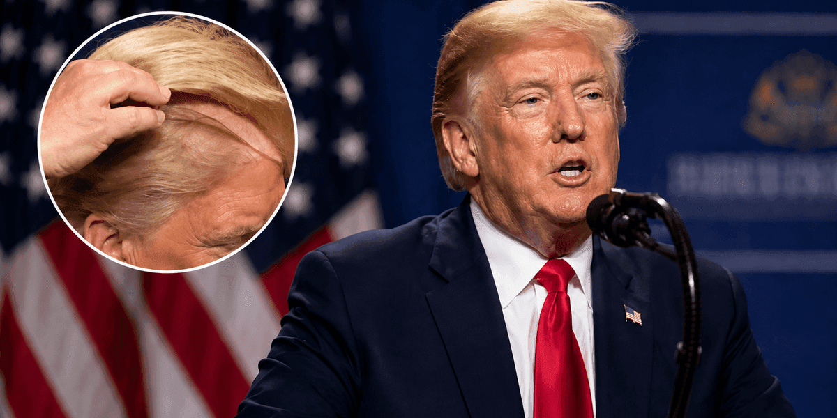 U përfol se presidenti amerikan mban paruke, Trump i përgjigjet komenteve: Era do të ma kishte marrë deri tash