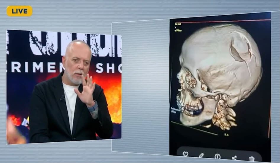 VIDEO / Rezonanca e policit të goditur në Shkodër: Protestuesit i thyen kafkën dhe…